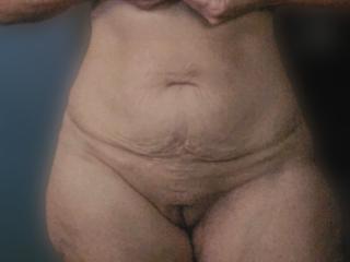 Handle bar hips