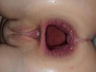 Wife Before and After Anal sex 3 of 4