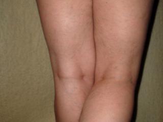 My natural legs. 3 of 6