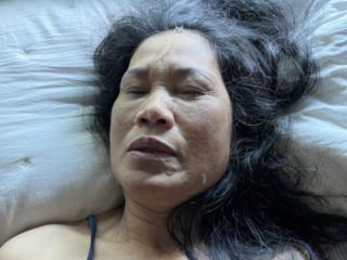 Blue Shirt Facial 7 of 20