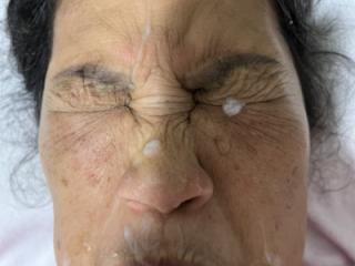More Of Last Night’s Facial
