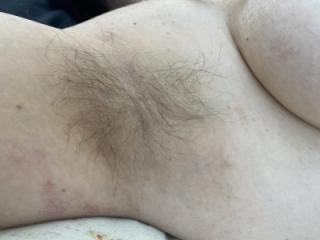 Hairy armpits 1 of 5