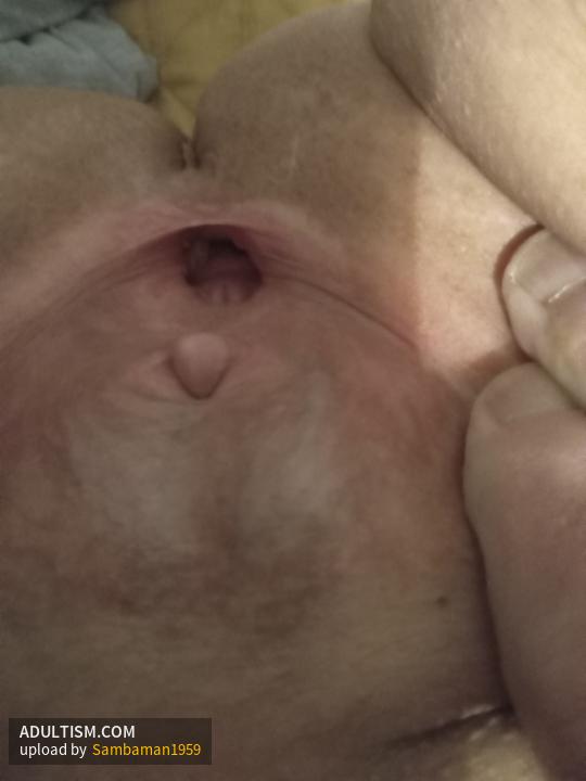 Image 5 of 5