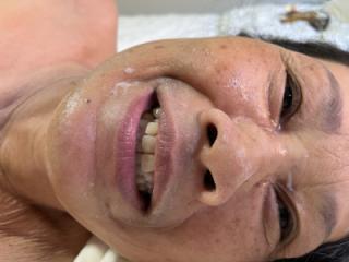 Naked Facial 7 of 16