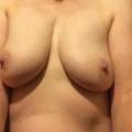 Mature saggy tits