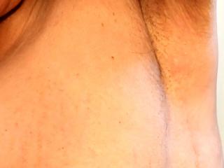 My armpits 5 of 7