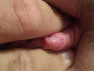 Close ups of big pussy and clit 4 of 6