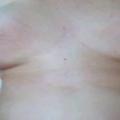 spread open