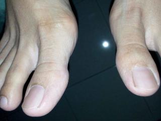 My long toes-malay 17 of 20