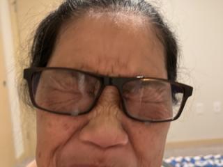 Eye Glasses Facial 11 of 13