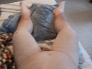 61old what hurt knee looks like other pics 6 of 8