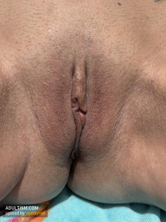 Image 2 of 10