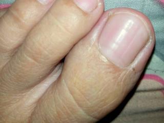 my new pic(long toes) 14 of 17