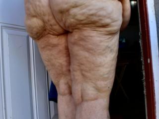 Cellulite, any one?