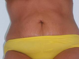 Yellow Bikini 3 of 6