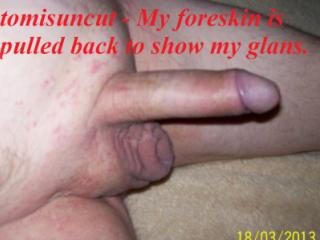 Tom Showing His Family Jewels (2) for Adultism 4 of 15