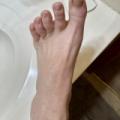 My Feet