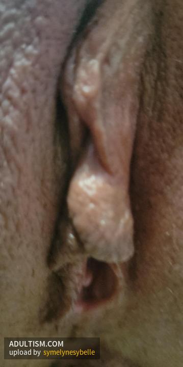 Image 4 of 11