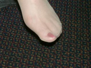 I love her smelly hosed feet 3 of 9