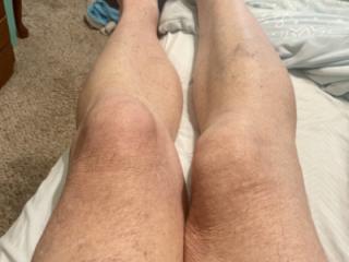 Legs, feet and toes 9 of 17