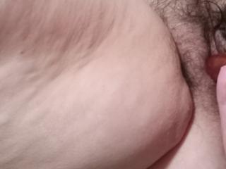 Wife cellulite 3 of 6