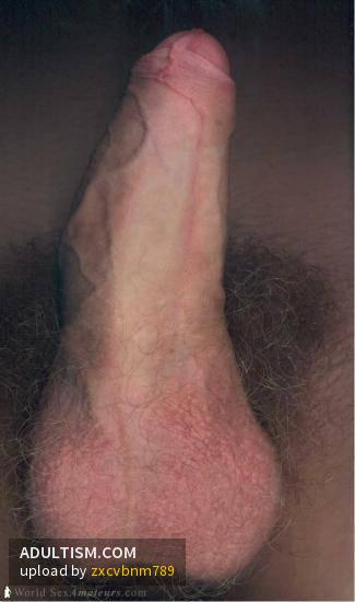 Image 2 of 2