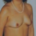 tits 3