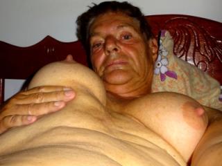 Huge transsexual milk titts grow with female hormones 5 of 7