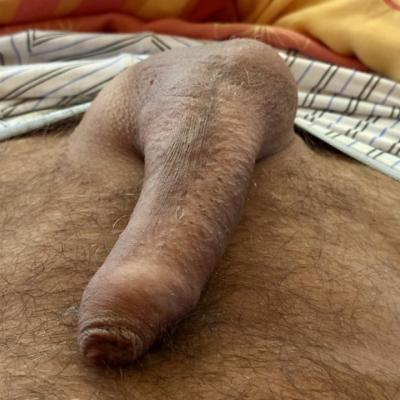 Fickfux