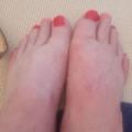 Topping up tan , toes and random