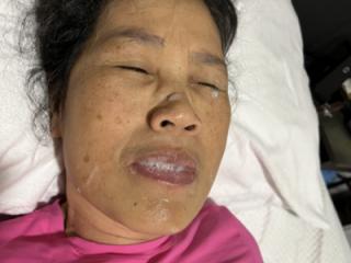 More Of Last Night’s Facial 6 of 16