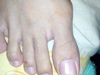 Malay feet n toes 4 of 16