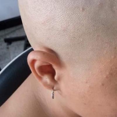 baldprincess