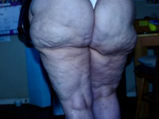 cellulite and sagginess 3 of 18