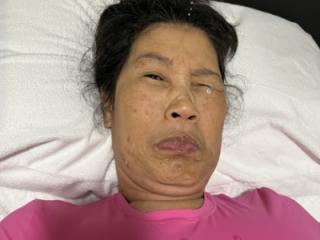 Last Night’s Facial 12 of 20