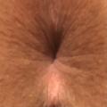 mesobubbley