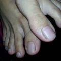Malay feet n toes