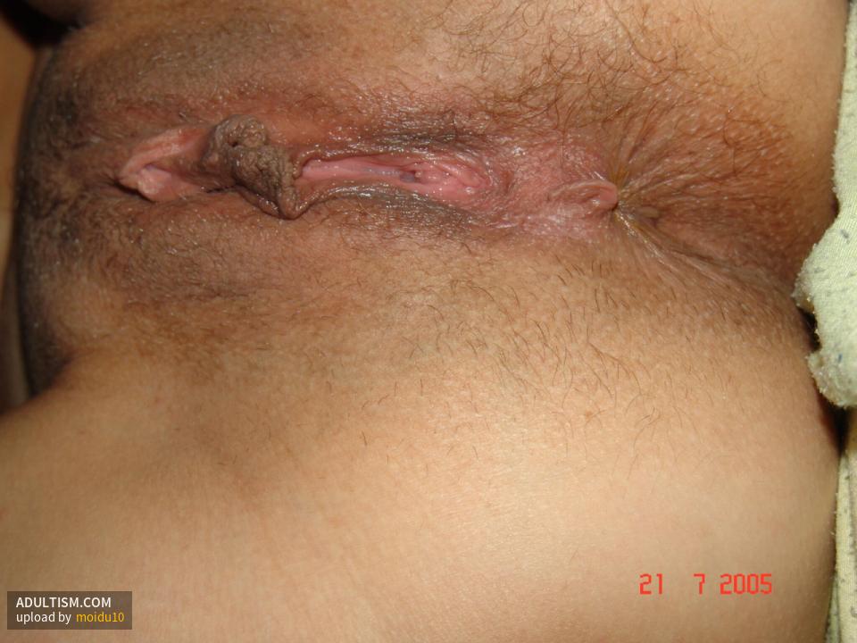 Image 3 of 5