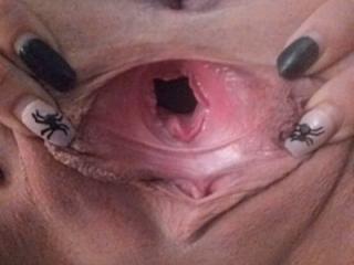 My gapes 3 of 5