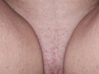 Foxtail Fuck 🦊 10 of 20