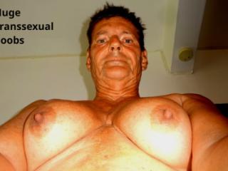 Huge transsexual milk titts grow with female hormones 3 of 7