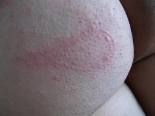 the whip on his skin 3 of 7