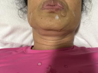 More Of Last Night’s Facial 13 of 16