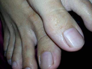 Malay feet n toes