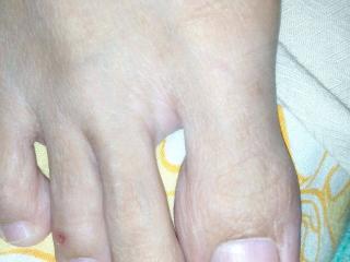 Malay feet n toes 3 of 16