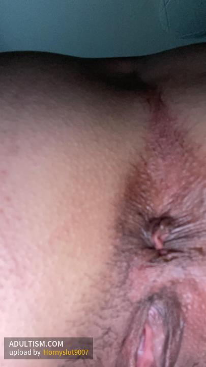 Image 1 of 11