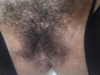 Hairy zoom