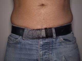 My broken jeans 2 of 4