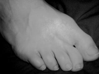Feet in Black & White (1) 2 of 20
