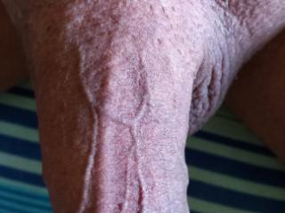 My Cock 2025 6 of 7